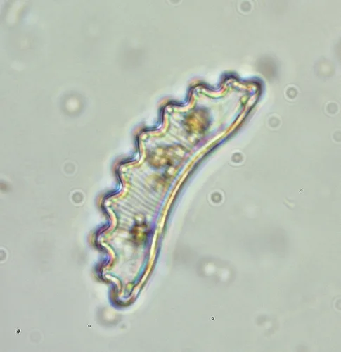 Diatoms (Eunotiaceae)