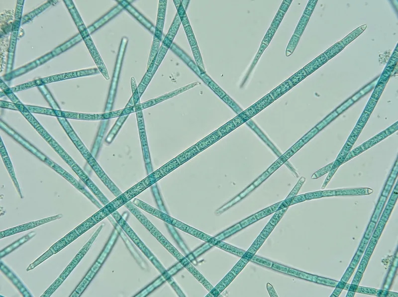The blue-green alga Planktothrix agardhii under the microscope